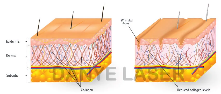 Eye Bag Removal Technology