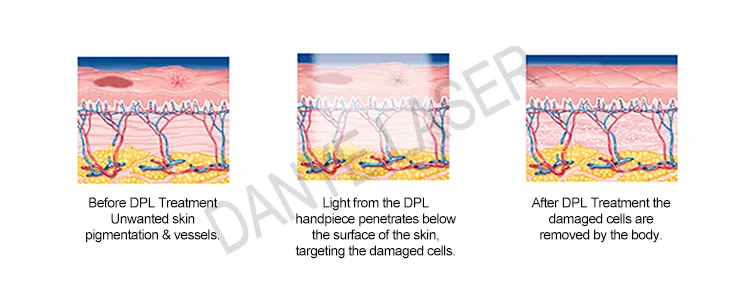 DPL Technology Rejuvenation