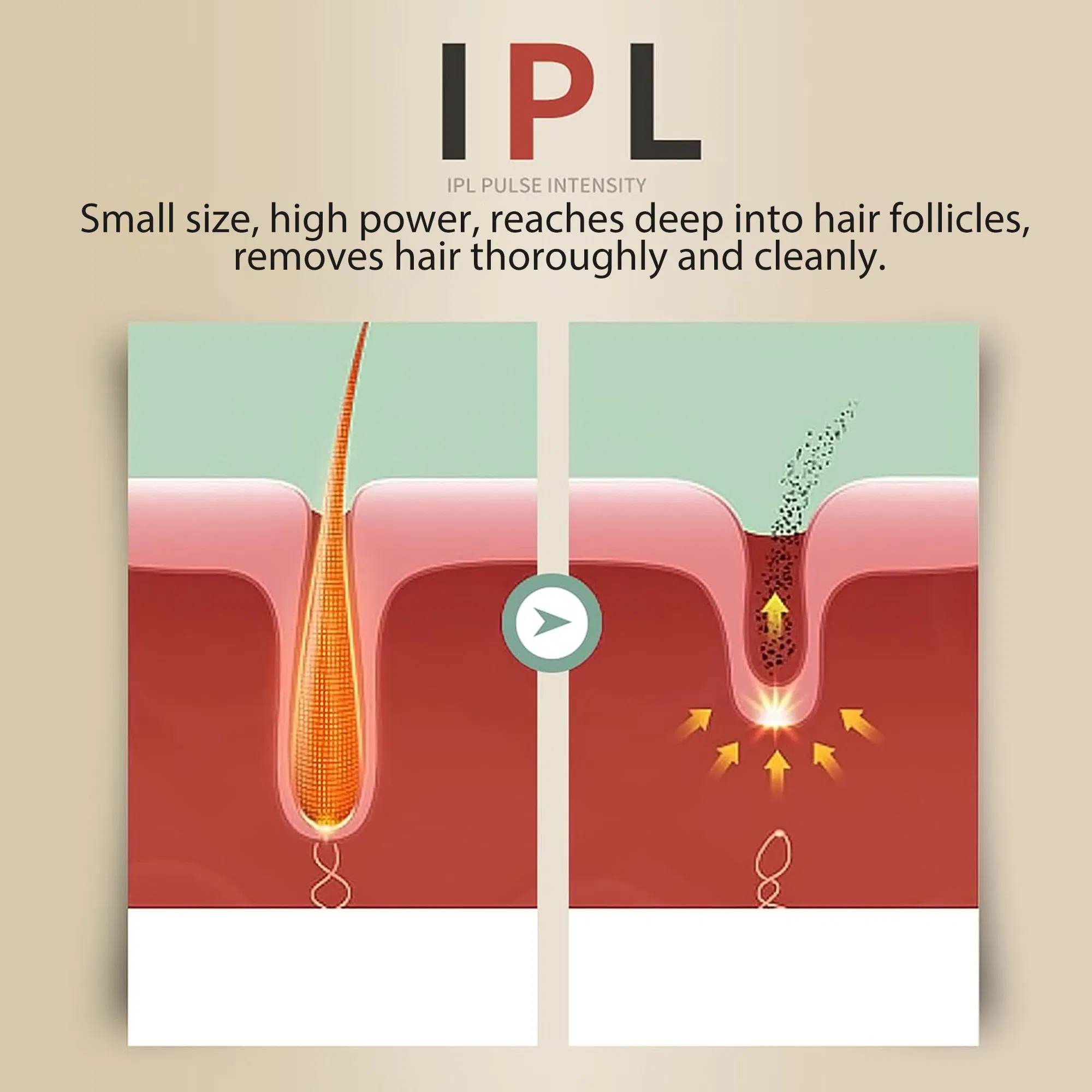 IPL Multi Function Handset Laser Skin Rejuvenation Painless Permanent Hair Removal Machine