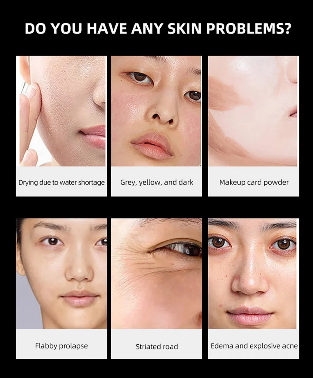 Radio Frequency Skin Care