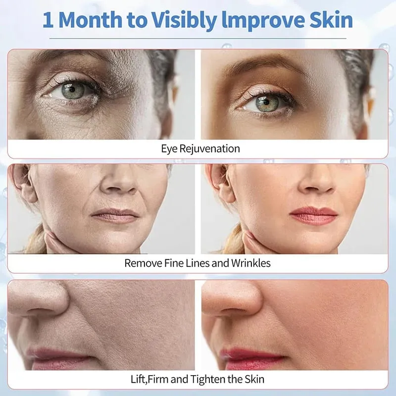 Skin Tightening Facial Device 6