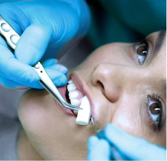 Dental Hemostasis Cotton Roll Surgical Absorbent Cotton Roll