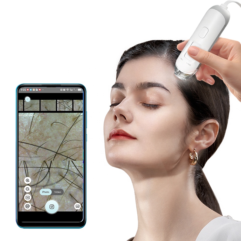 Kimairay HD White Hair Skin Scalp Analyzer USB &amp; WIFI Connected Hair Follicles Scanner Home Use Skin Detector and Analyzer