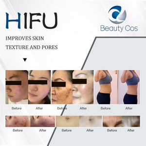 25D Hifu Machine 360 MAX Hifu Focal Therapy Skin Tightening Machine Non-invasive Face Lift Machine Slimming Device for Salons