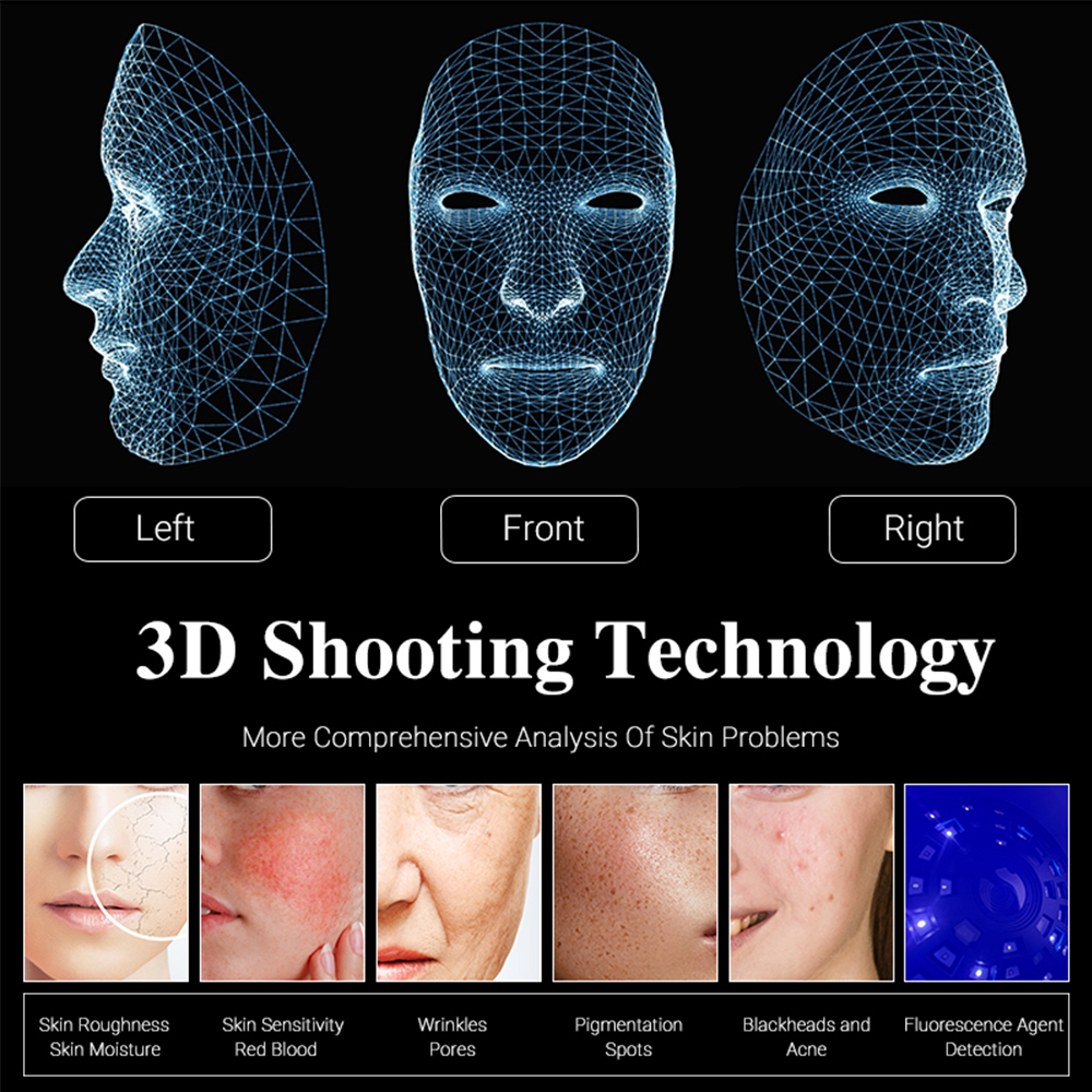 Winkonlaser Advanced Facial Skin and Scalp Professional Ai Analysis Device Supports Customized Treatment Plan Making