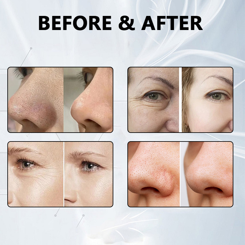 OEM / ODM 14 in 1 Professional Skin Rejuvenation Facial Cleansing Lifting Oxygen Facial Skin Care Beauty Equipment