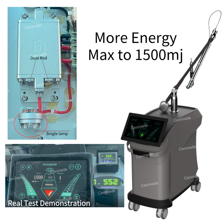 Salon Beauty Machine