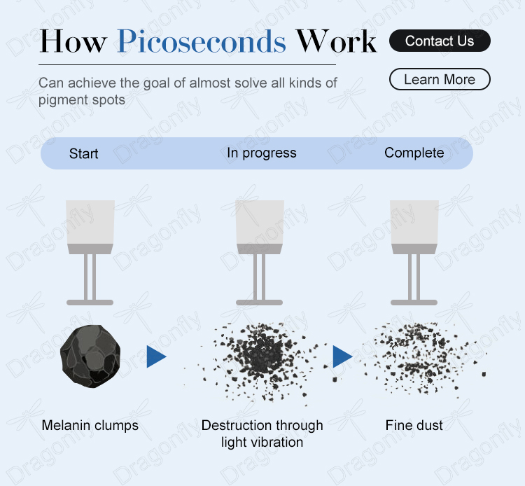 Profit-Driven Pico Laser System for Aesthetic Businesses - Fast Treatment Cycles to Increase Client Turnover