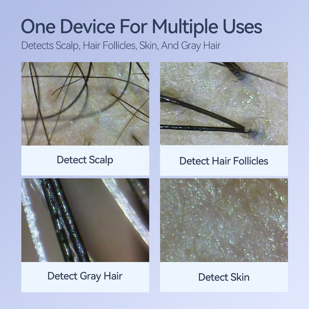 Kimairay HD White Hair Skin Scalp Analyzer USB &amp; WIFI Connected Hair Follicles Scanner Home Use Skin Detector and Analyzer