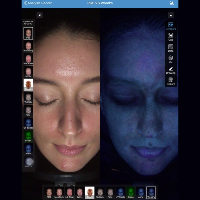 MEICET MC88 Analysis Manufacturer Test Machine System Facial Digital Device Scanner 3D for Skin Analyzer Distributor Sale