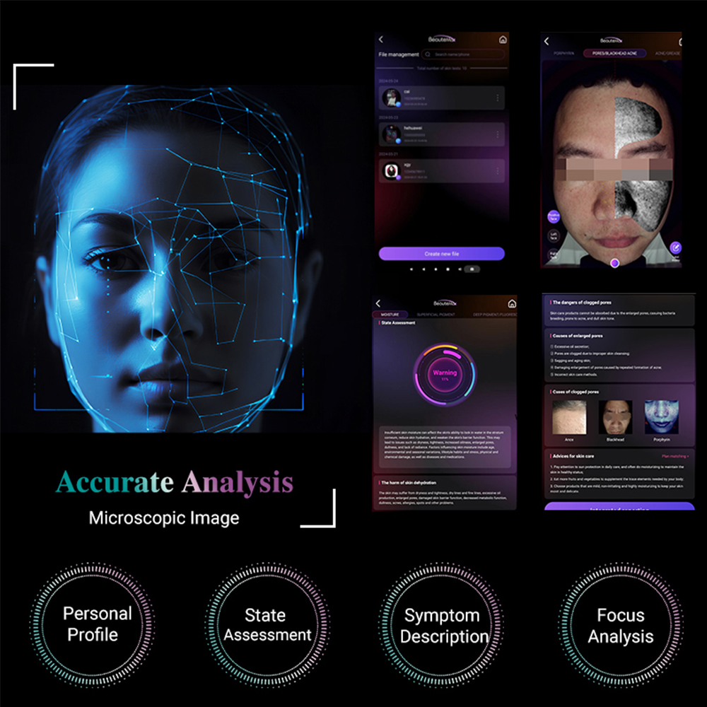Winkonlaser Advanced Facial Skin and Scalp Professional Ai Analysis Device Supports Customized Treatment Plan Making