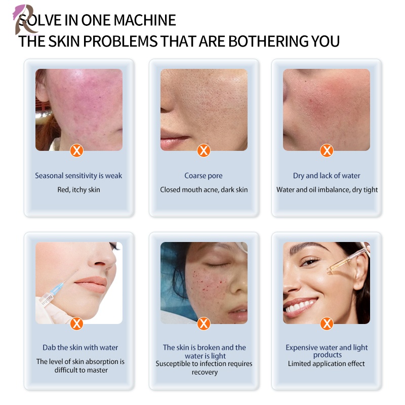 Hot Selling Non-invasive Light Injection Improve Dark Dry Rough Facial Skin Machine