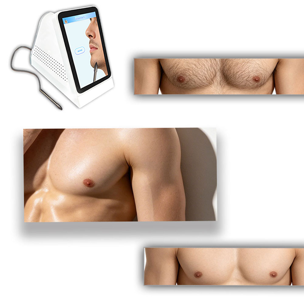 Salon Smart CNC Electrolysis Device Precise Power Adjust All Skin Types