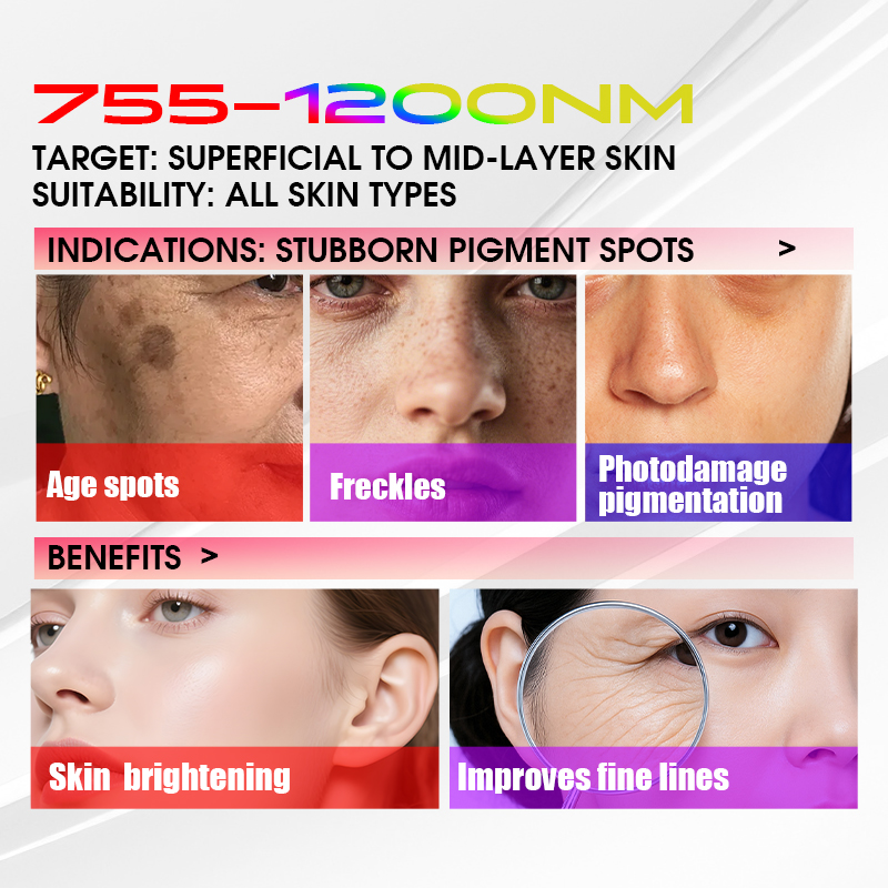 Best Seller BBL Broadband Light System for Anti Aging Collagen Production Skin Elasticity Improvement