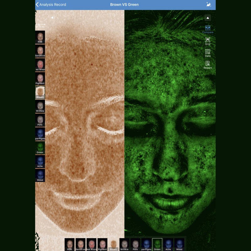 MEICET MC88 Analysis Manufacturer Test Machine System Facial Digital Device Scanner 3D for Skin Analyzer Distributor Sale