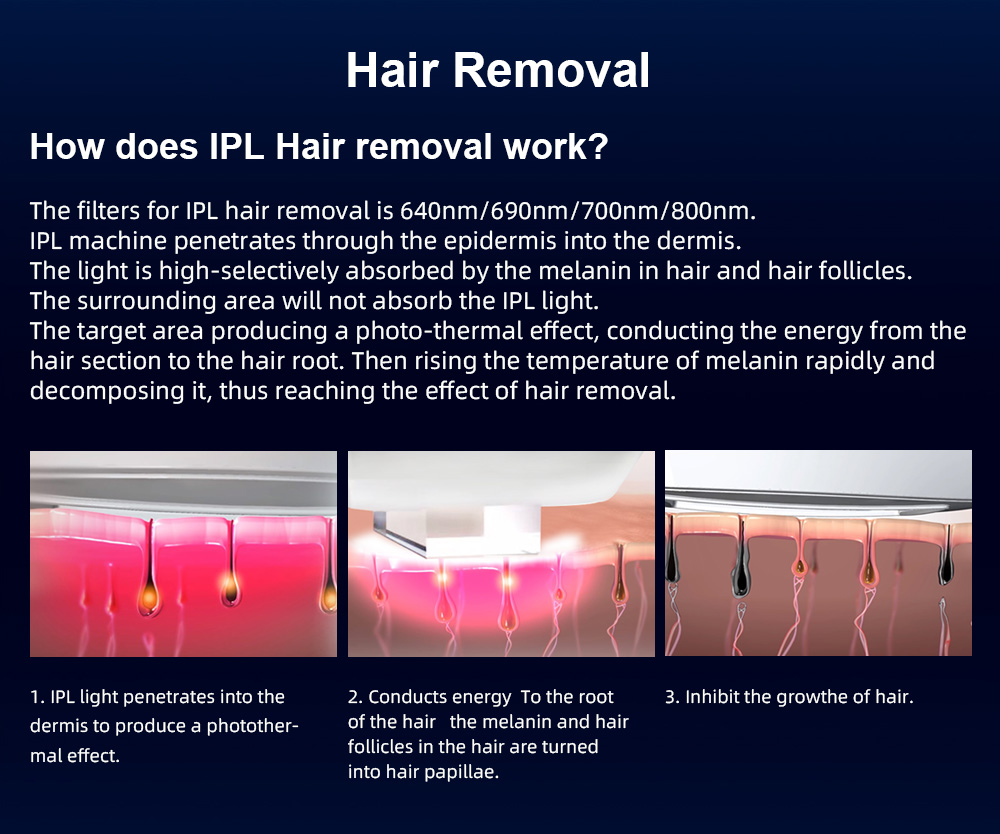 IPL Professional Laser Machine For Salons Permanent Hair Removal With Advanced OPT Cooling Technology Clinic Medical Grade DPL