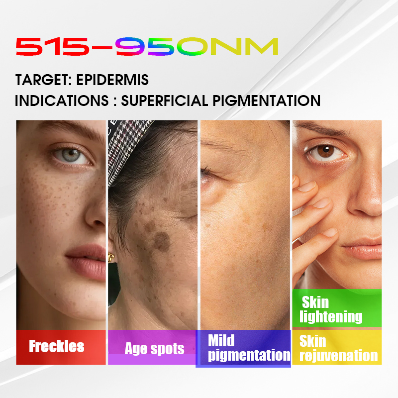 Best Seller BBL Broadband Light System for Anti Aging Collagen Production Skin Elasticity Improvement