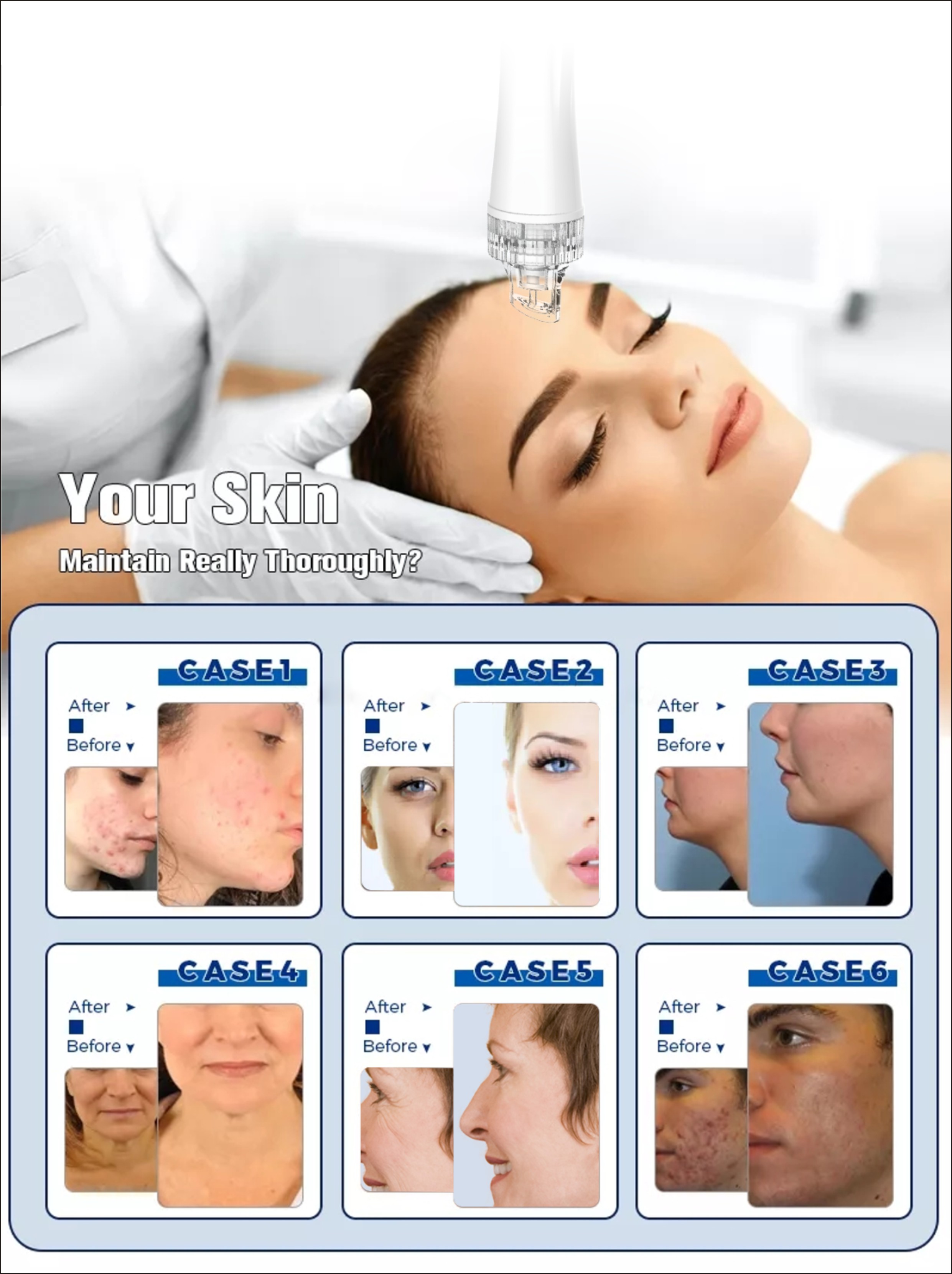 Skin Rejuvenation