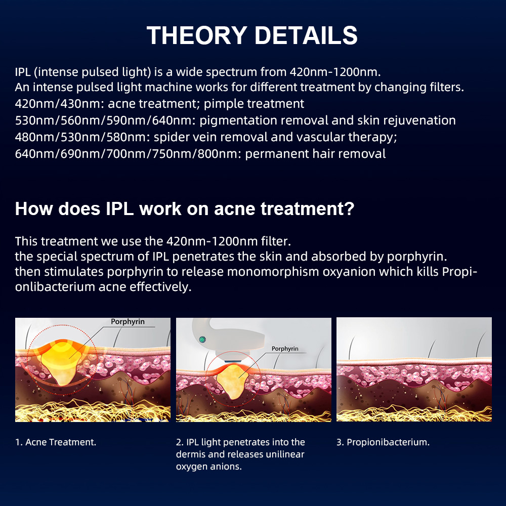 IPL Professional Laser Machine For Salons Permanent Hair Removal With Advanced OPT Cooling Technology Clinic Medical Grade DPL