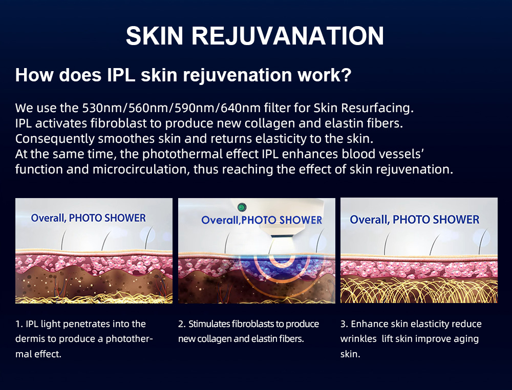 IPL Professional Laser Machine For Salons Permanent Hair Removal With Advanced OPT Cooling Technology Clinic Medical Grade DPL