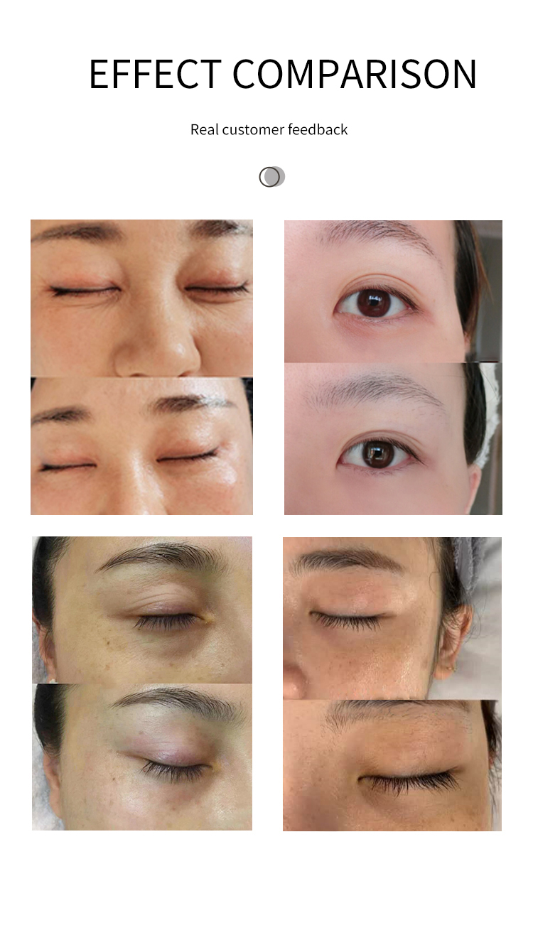 3-in-1 Eye Care Dark Circle Remover Bio Face Lift Portable Device with Mask Clip