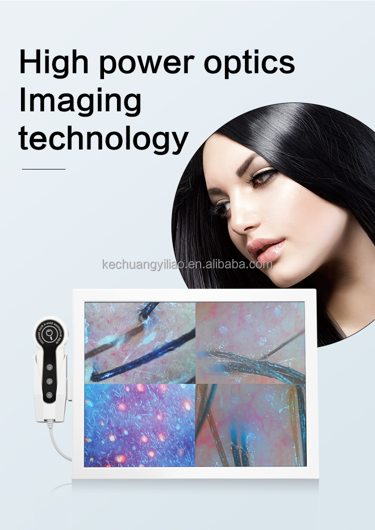 2024 Multi-function Skin Analyzer Hair Detector Beauty Salon Dedicated Hair Regeneration Treatment Scalp Analyzer