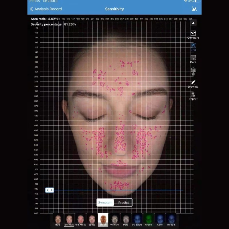 3D Smart Analyzer Type Facial Age Skin Analyzer Digital Camera Scanner Analysis Equipment Factory Machine for Sale