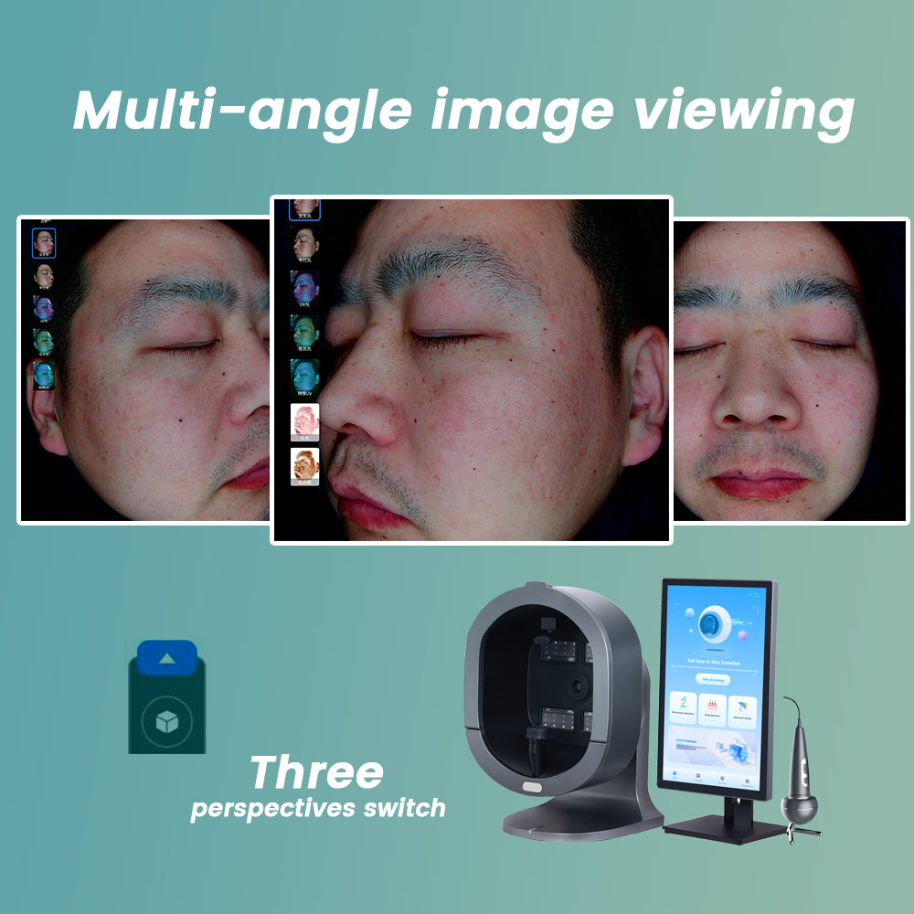 Portable Magic Mirror Face Scanner Pigmentation Analysis 3d Skin Analyzer Facial Skin Analyzer Machine