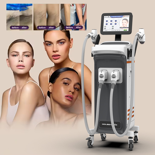 Nubway Newest Professional Ice Laser Hair Removal 755 808 940 1064 Diode Laser Hair Removal Machine