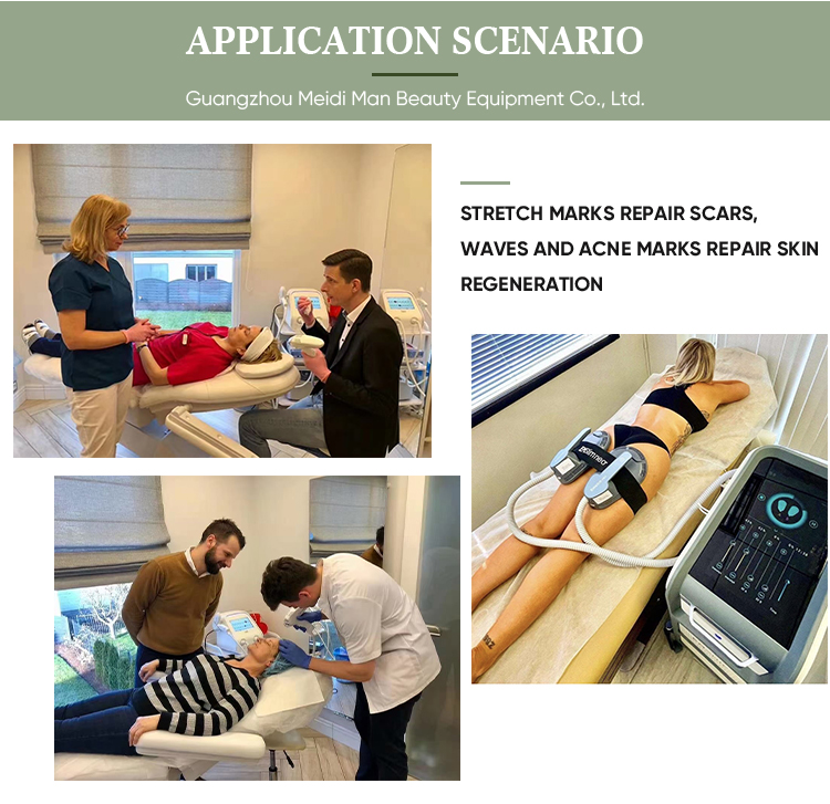 Treatment Application