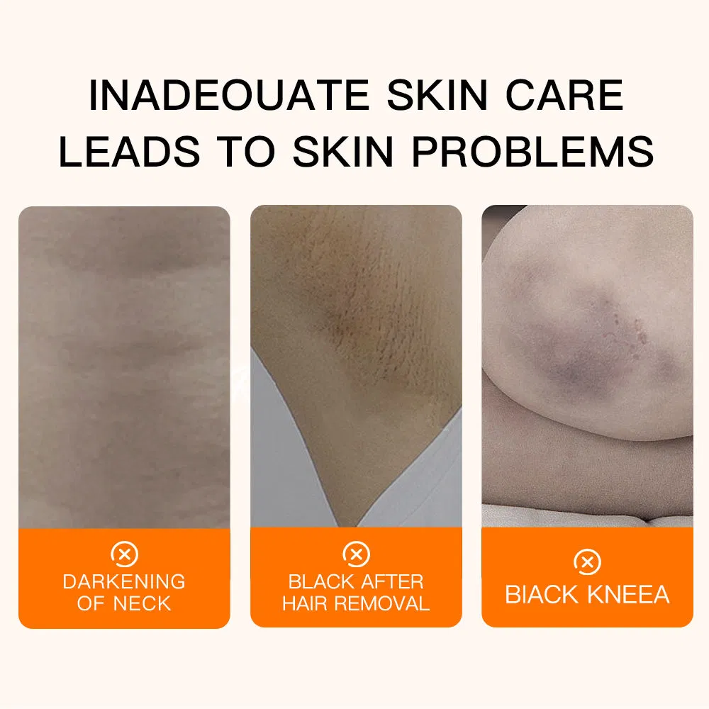 Aiooce Deep Brightening Repair Dark Spot Correcting Cream