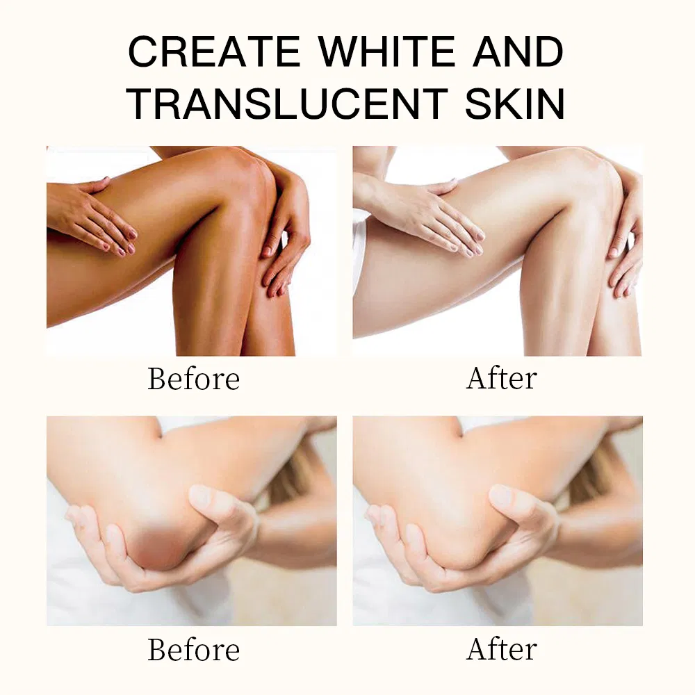 Dark Spot Correcting