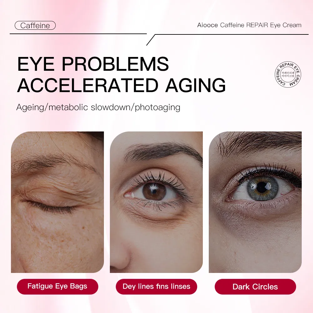 Anti-Wrinkle Eye Cream