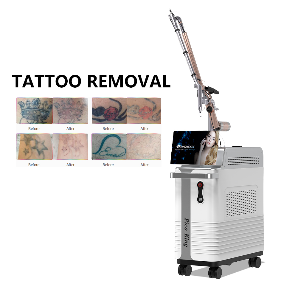 Pico Laser Machine Pigment Removal 3000W Tattoo Removal Machine with 730ps Picosecond Laser