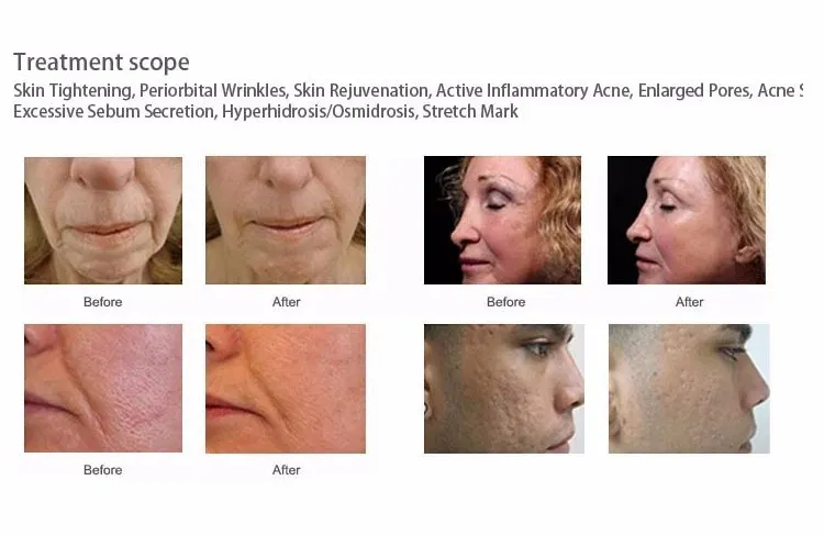 Treatment Applications Grid