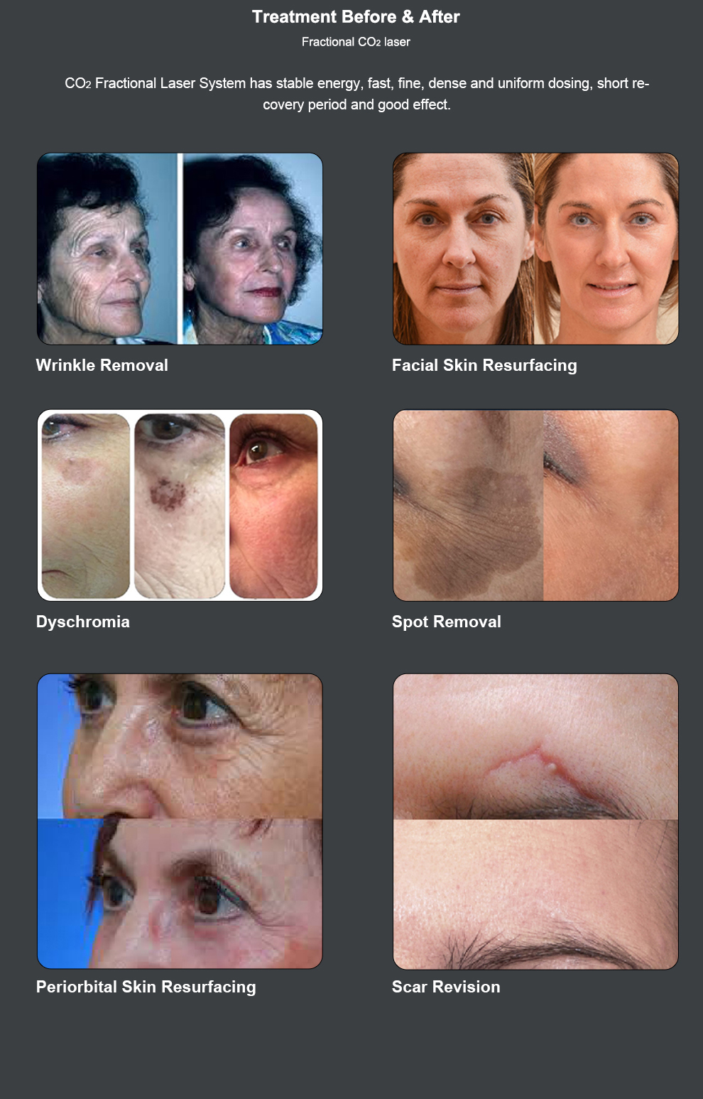 Clinical Results