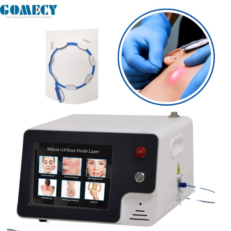 635nm 980nm 1470nm 3 Wavelength Laser System for Face Lift, Vascular Therapy &amp; Anti-Aging Procedures