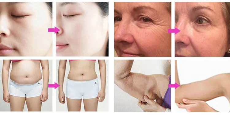 Before and After Treatment Results