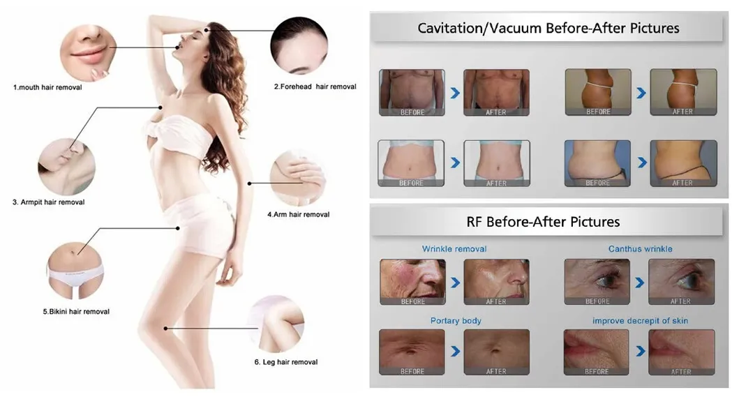 6 in 1 Slimming Device