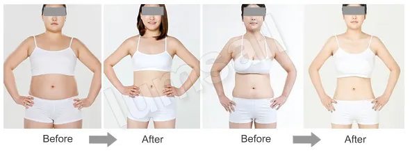 Treatment Result