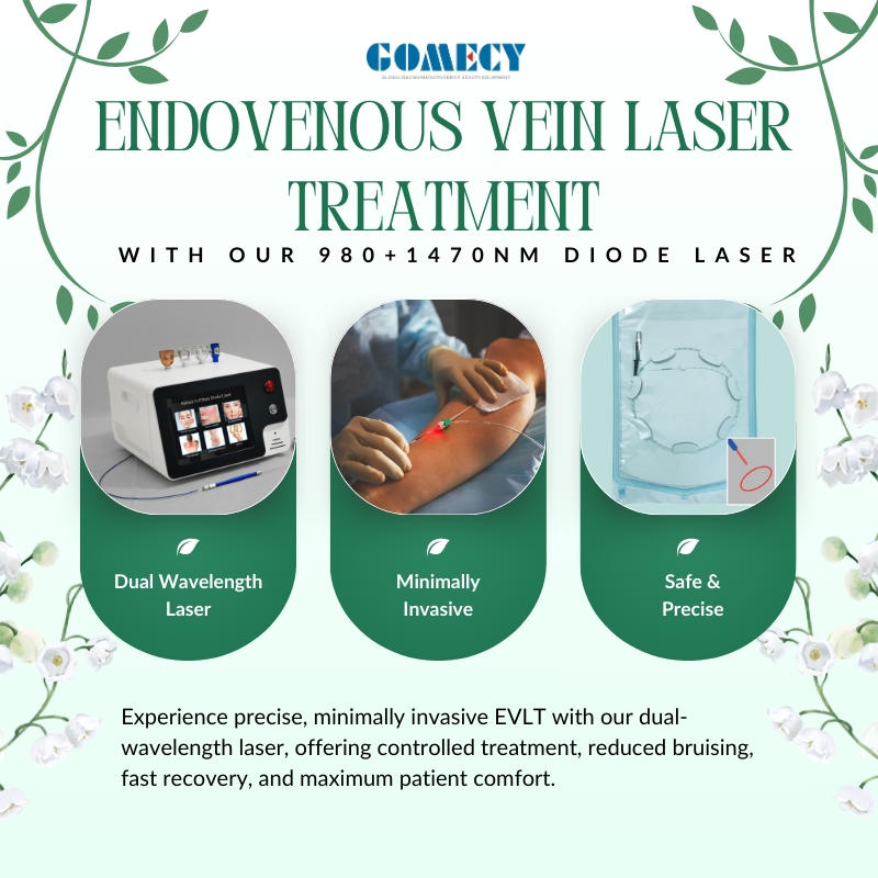 1470nm Endovenous Laser Vein Therapy System for Minimally Invasive Vascular Treatment