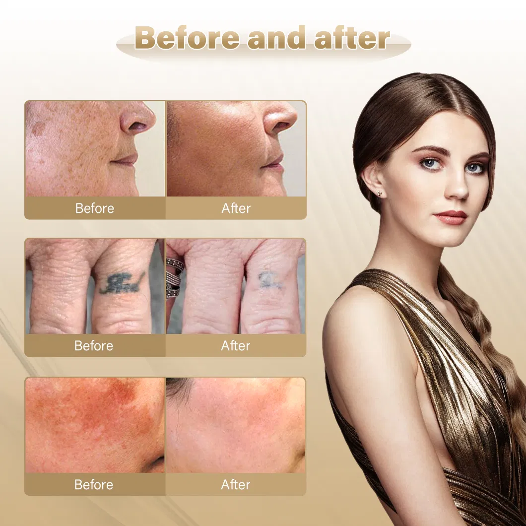 Treatment Results