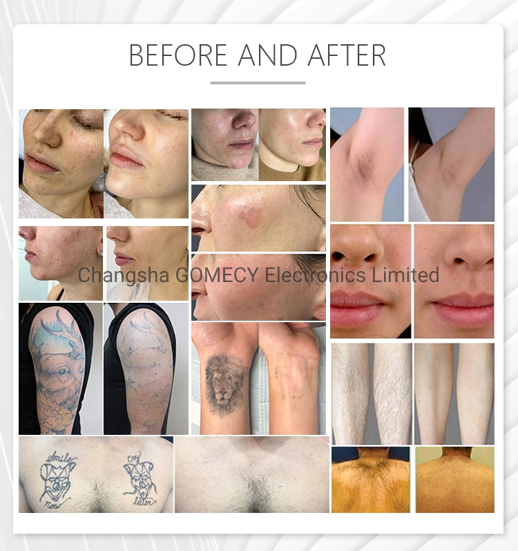 Before After Results
