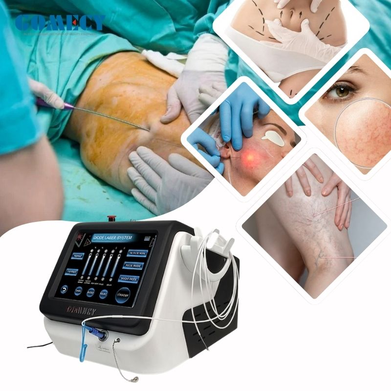 15W Medical 980nm 1470nm Diode Laser System for Onychomycosis and Physiotherapy Pain