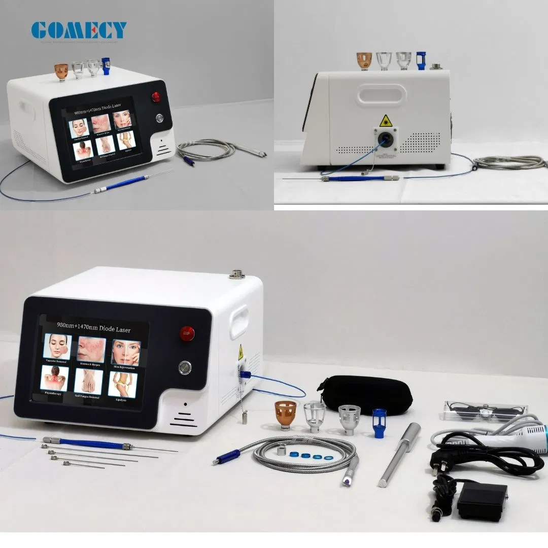 Endolaser 980 1470 Diode Laser Effective Result Vascular 980m Laser Machine System 1470nmfiber
