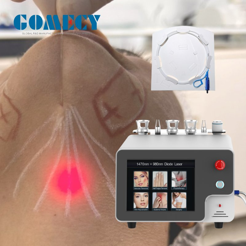 1470nm/1940nm Laser Evlt Evla Endolaser Vein Surgery Endovenous Laser 1470nm Laser Ablation System