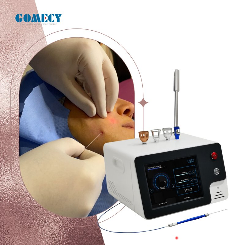 Professional Dual Wavelength 980 1470nm Diode Laser System for Dermatology Clinics and Beauty Centers