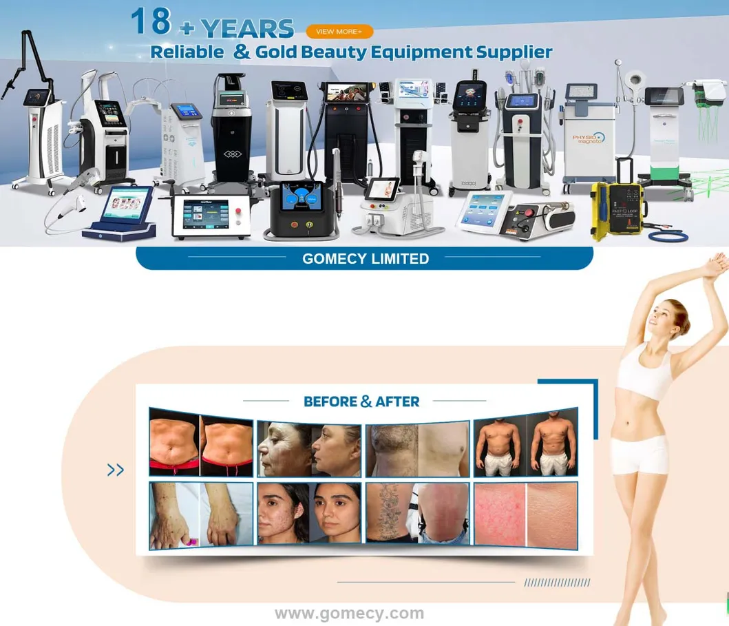 Handpiece