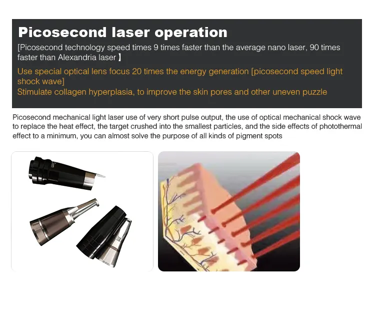 Picosecond System 5