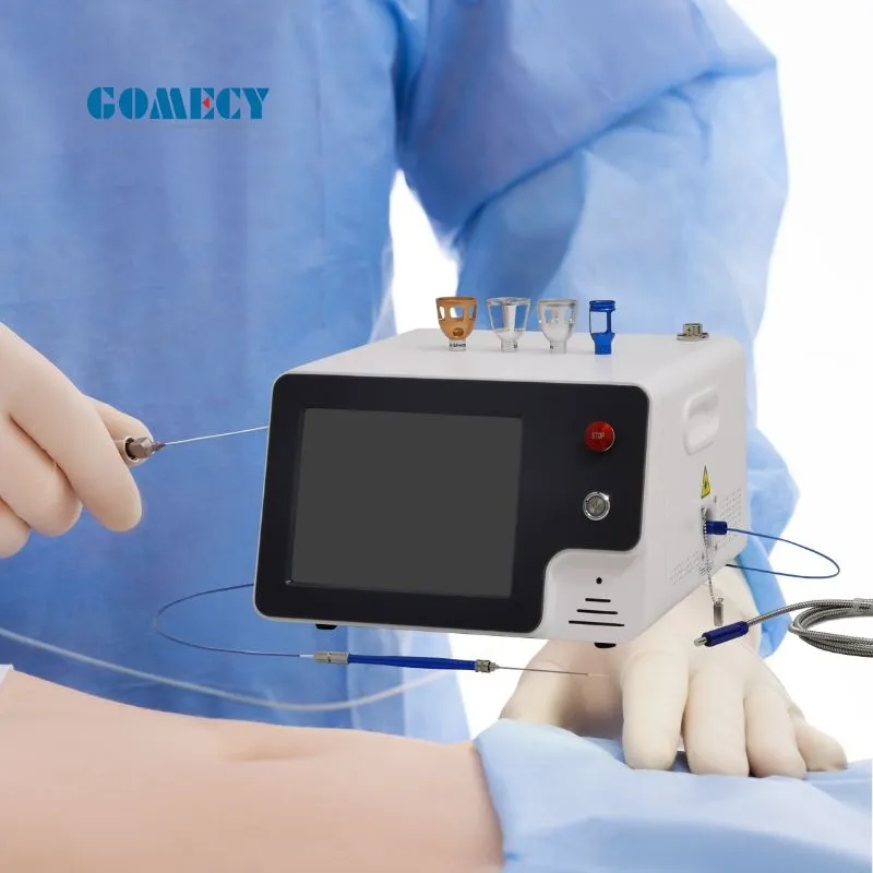 Spider Vein Removal